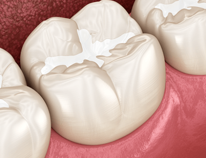 One & Only Dental - treatment