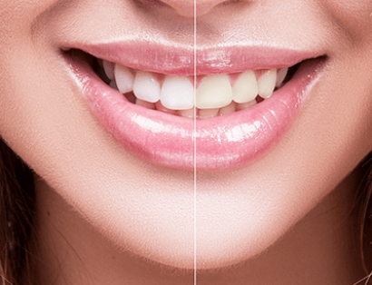 One & Only Dental - treatment